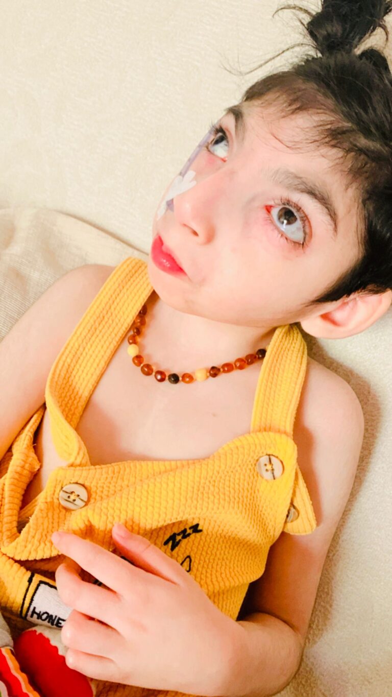 Yusuf’un Yaşam Mücadelesine Destek Olun