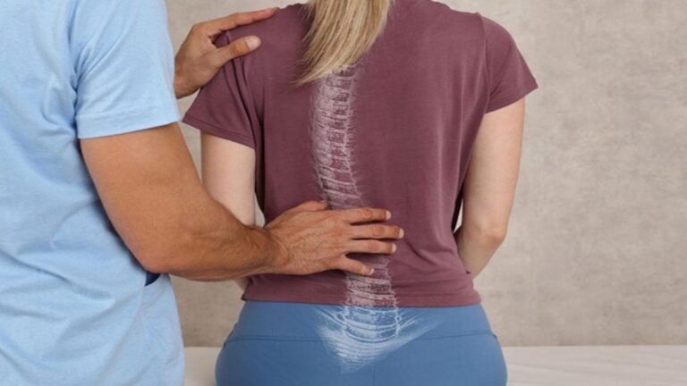 Skolyoz Nedir? Skolyoz Belirtileri, Nedenleri ve Tedavi Yöntemleri Nelerdir?