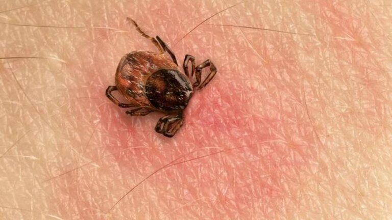 Kene Nedir, Nasıl Anlaşılır? Kene Isırığı Tedavisi Nasıl Yapılır?